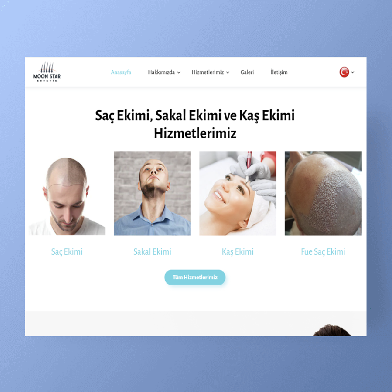 MoonStar Saç Ekimi Kurumsal Web Tasarım